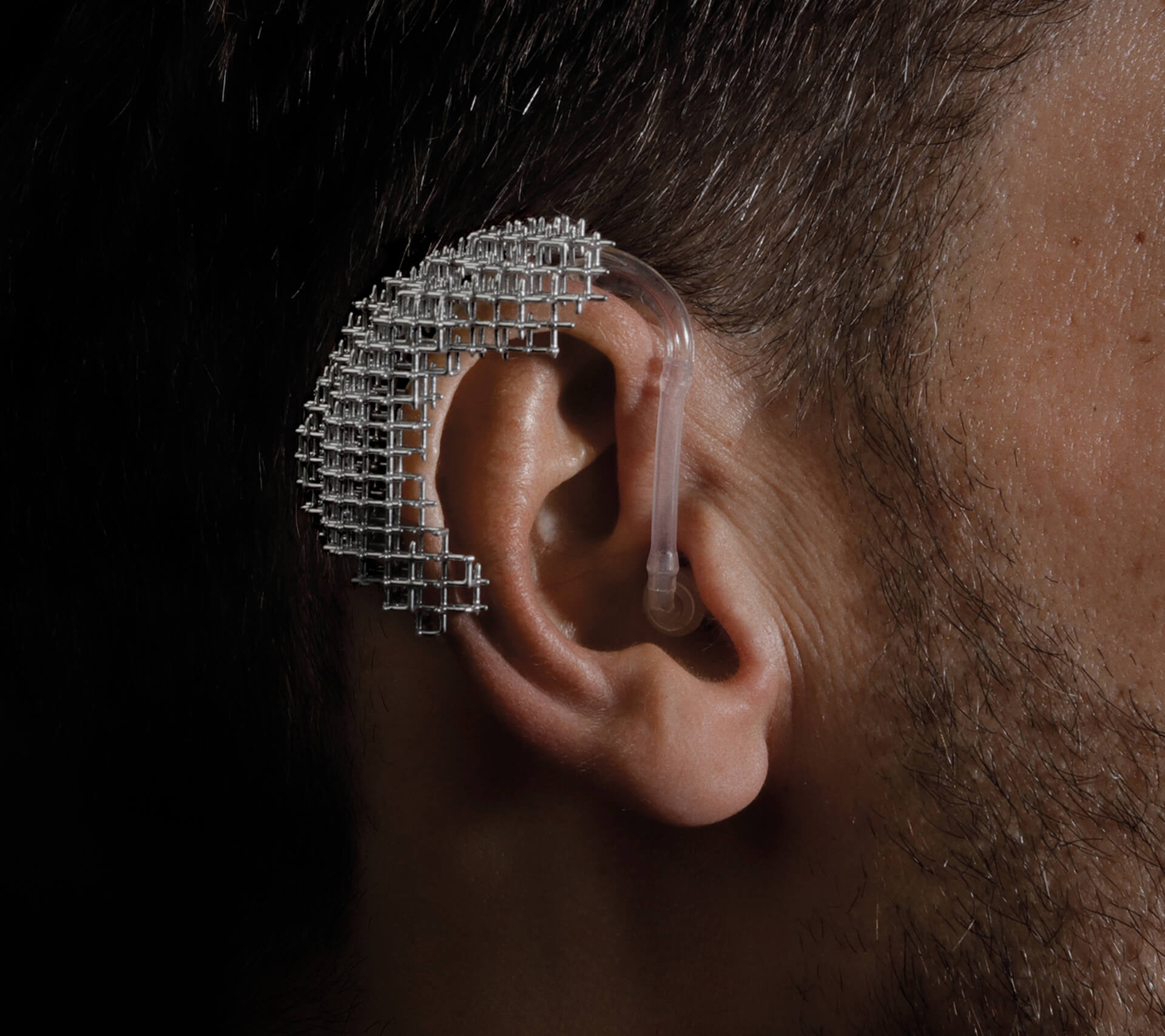 About the Importance of the Superfluous